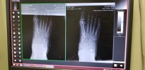 X-ray images